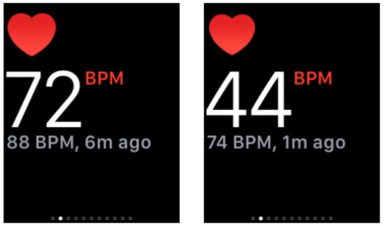 Morning Resting Heart Rate Chart