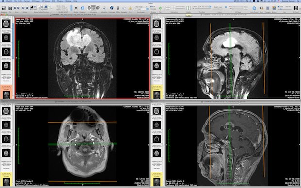 OsiriX DICOM MRI Imagery Viewer для Mac OS X