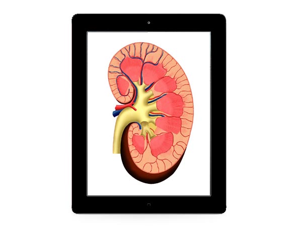Kidney iPad 2