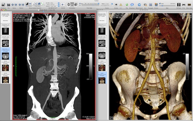 3D MRI image DCM renderer 