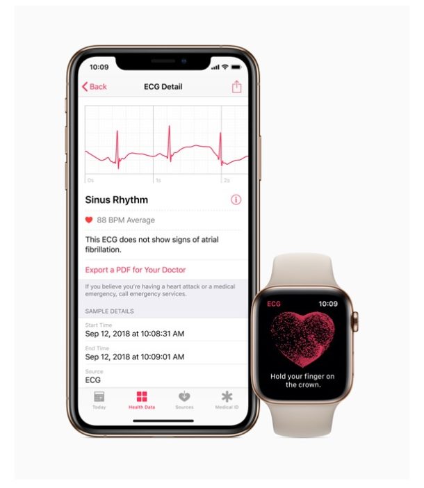 Apple Watch with ECG feature