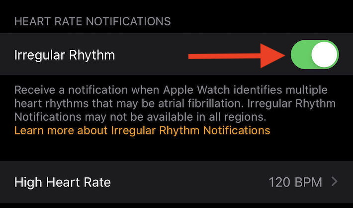 Enable irregular rhythm notifications